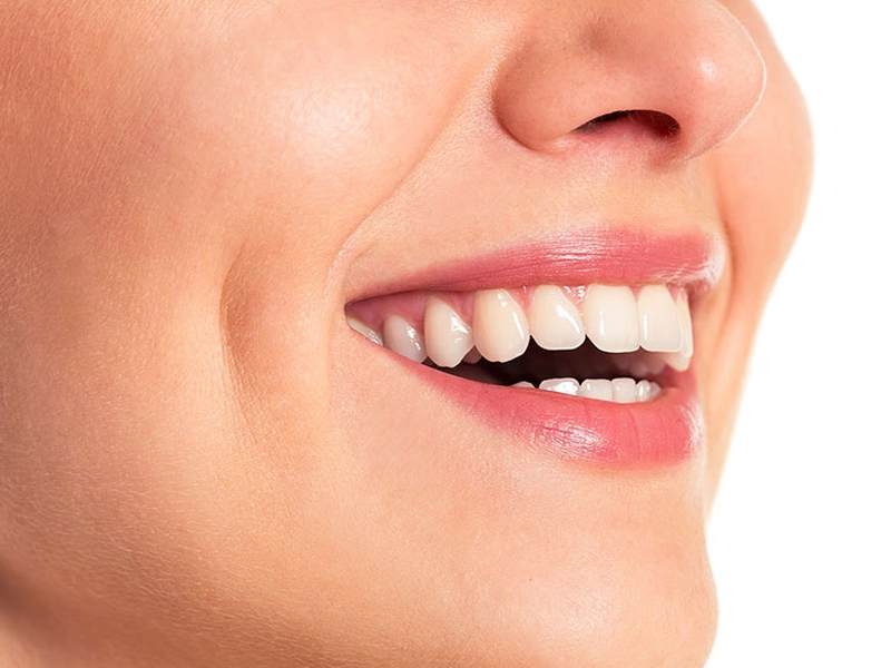 Má lúm đồng tiền có bị mất không 2