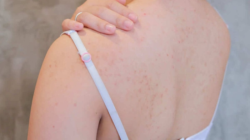 Mặc áo ngực nhiều có tốt không? Mách nàng cách mặc áo ngực tốt cho sức khỏe 4