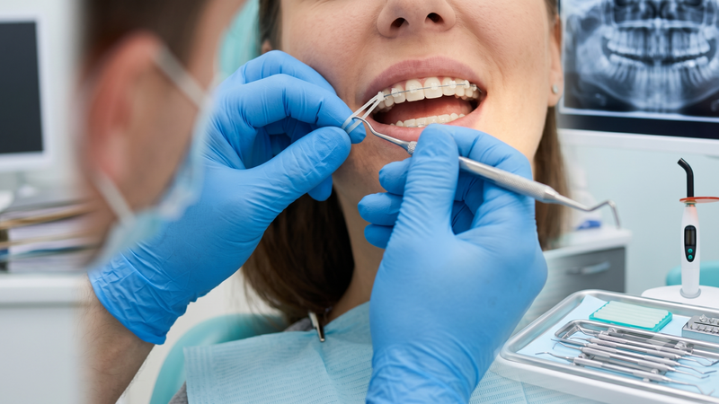 Người niềng nên tuân thủ lịch tái khám định kỳ của bác sĩ chỉ định