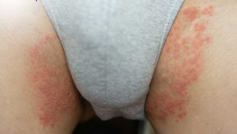 Mặc chung quần lót nam có sao không? 1