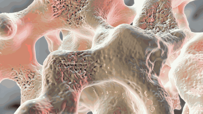 Hệ xương yếu dần, gây loãng xương khi lạm dụng macchiato trong thời gian dài