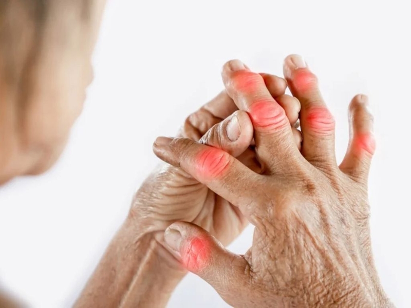 Mách bạn 10 bài thuốc nam trị viêm khớp hiệu quả và an toàn được sử dụng phổ biến hiện nay 1