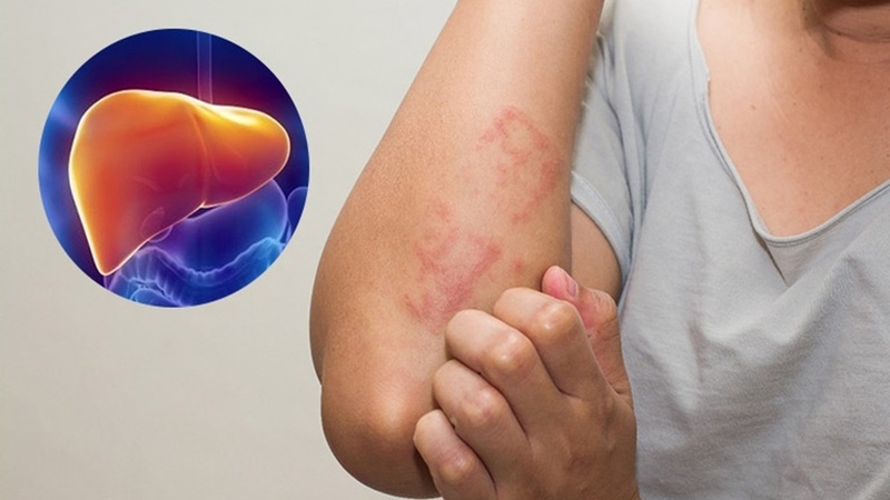 Mách bạn bí quyết giải độc gan cải thiện sức khỏe 3