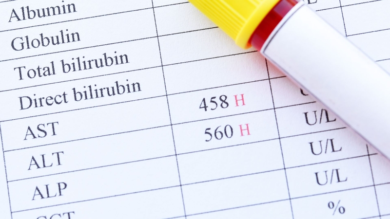 Tăng men gan được hiểu là tình trạng nồng độ các enzyme gan trong máu cao hơn giới hạn bình thường