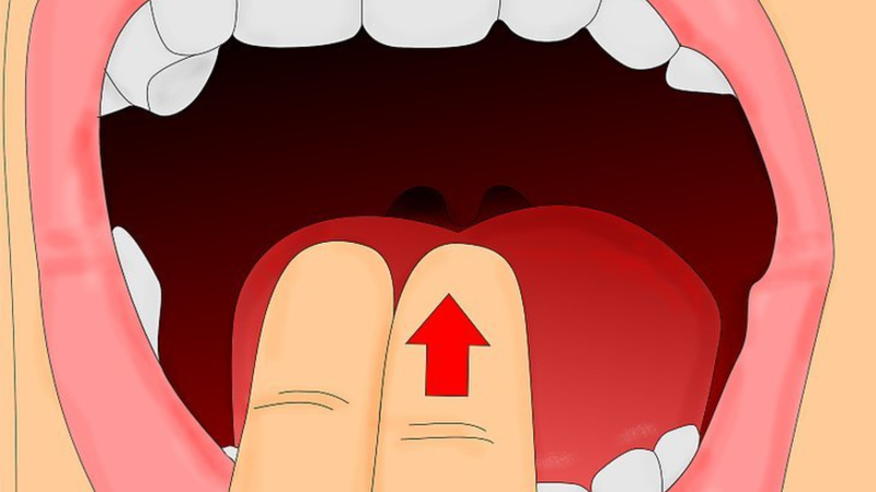 Mách bạn cách gây nôn khi bị ngộ độc 2