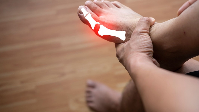 Bệnh gout là hậu quả của tình trạng tăng acid uric máu kéo dài