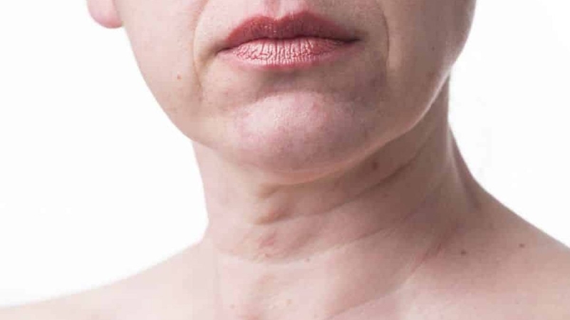 Mách bạn cách trị ngấn cổ với Vaseline vô cùng đơn giản 1