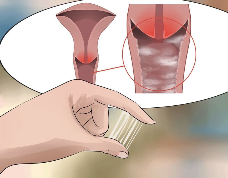 Mách bạn những bài thuốc Đông y trị ngứa vùng kín 1