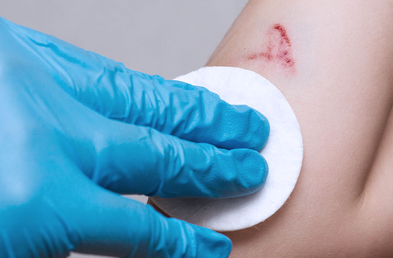 Tham khảo các tiêu chí lựa chọn gel bôi vết thương hở hiệu quả, an toàn 1