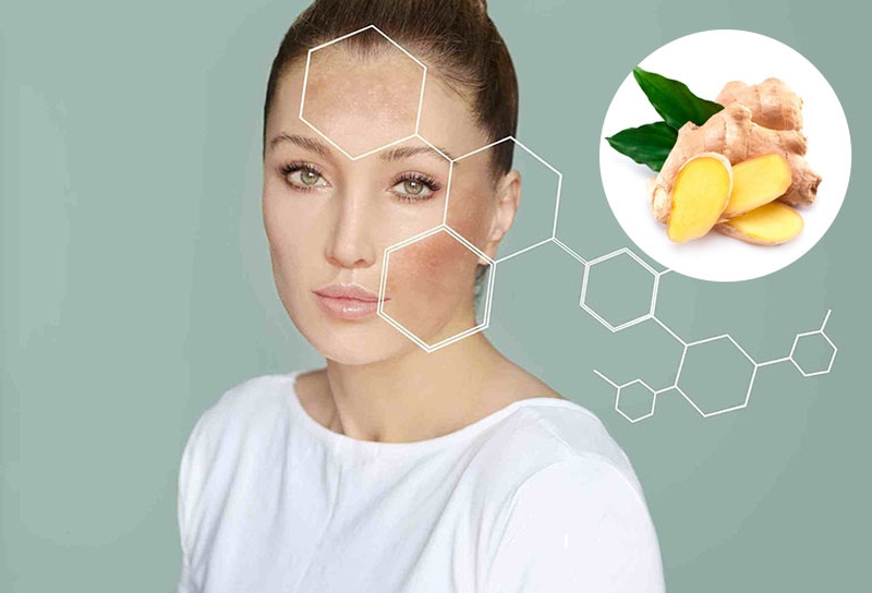 Mách bạn top 5 cách trị đồi mồi bằng gừng hiệu quả tại nhà 2