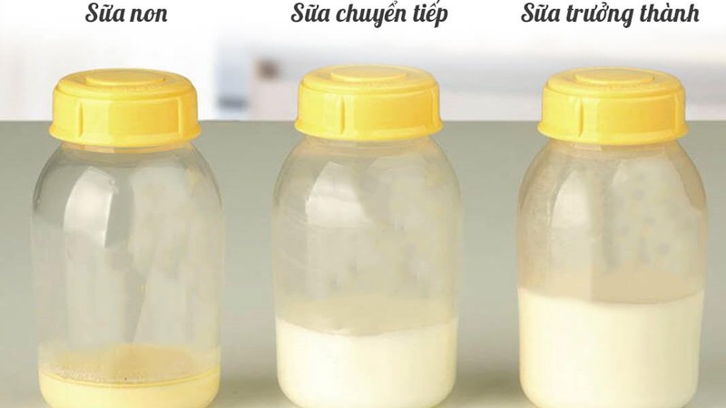 Mách chị em bí quyết trị mụn sau sinh bằng sữa mẹ 2