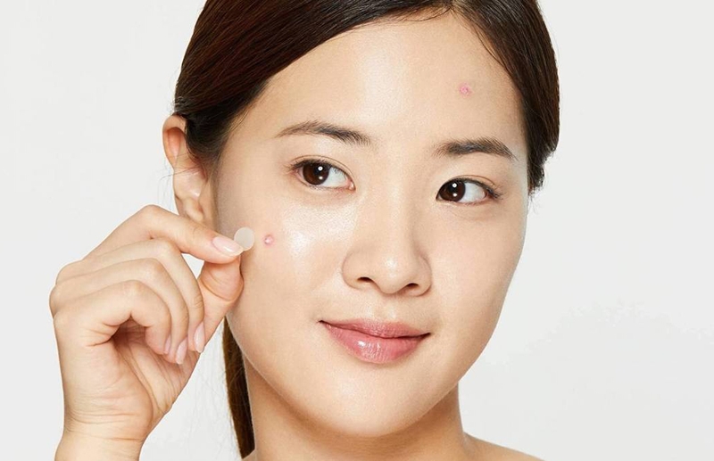 Mách chị em cách chọn mua miếng dán mụn phù hợp