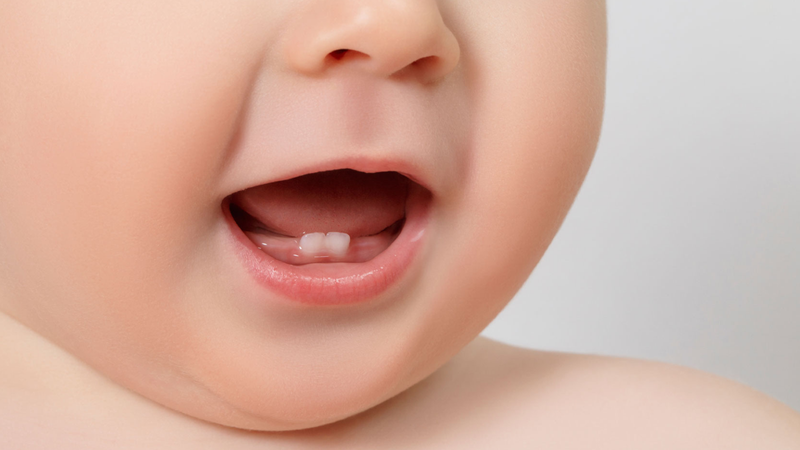 Mách mẹ chữa hôi miệng trẻ em dễ thực hiện 1