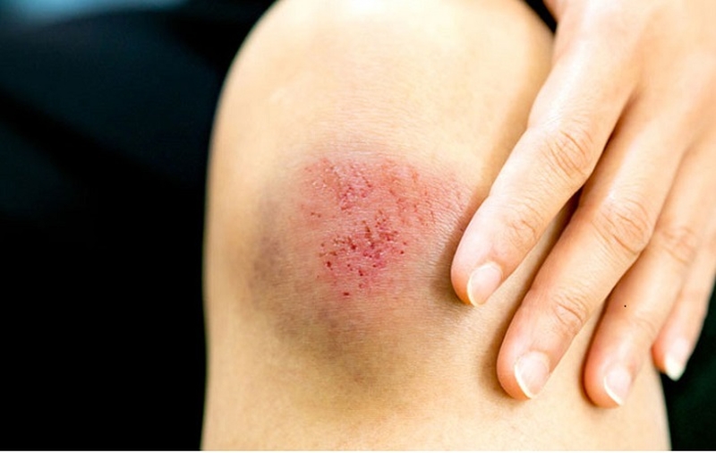 Tác dụng của mật ong đối với sức khỏe 3