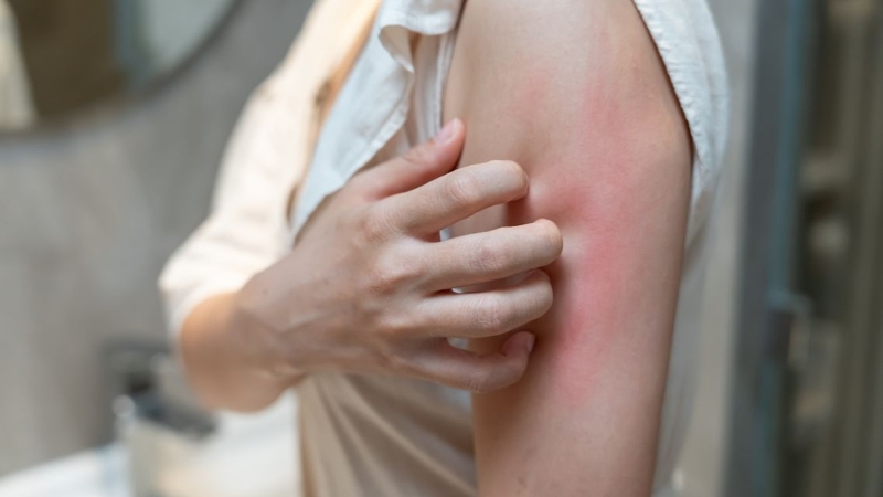 Ngứa kéo dài, tái phát nhiều lần cần được thăm khám để xác định nguyên nhân