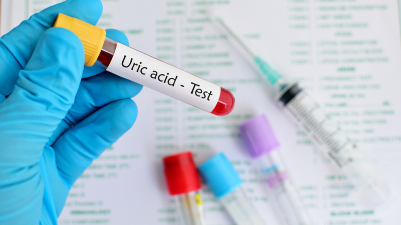 Một chế độ ăn hợp lý có thể góp phần hỗ trợ kiểm soát acid uric