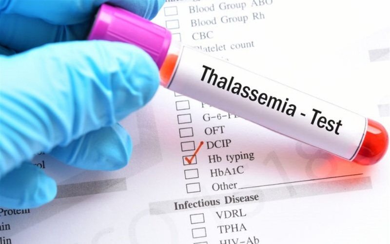 Mang gen thalassemia có nên uống sắt không? Những điều cần chú ý khi mang gen thalassemia 3