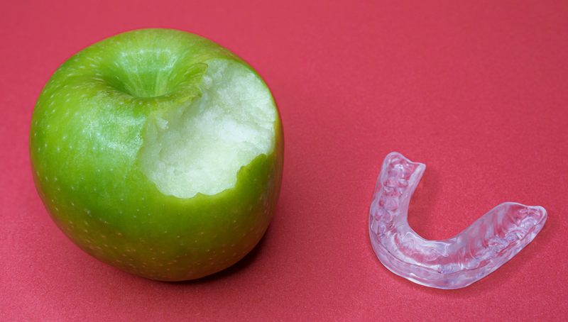 Máng nhai: Giải pháp bảo vệ răng miệng hiệu quả cho mọi lứa tuổi 3