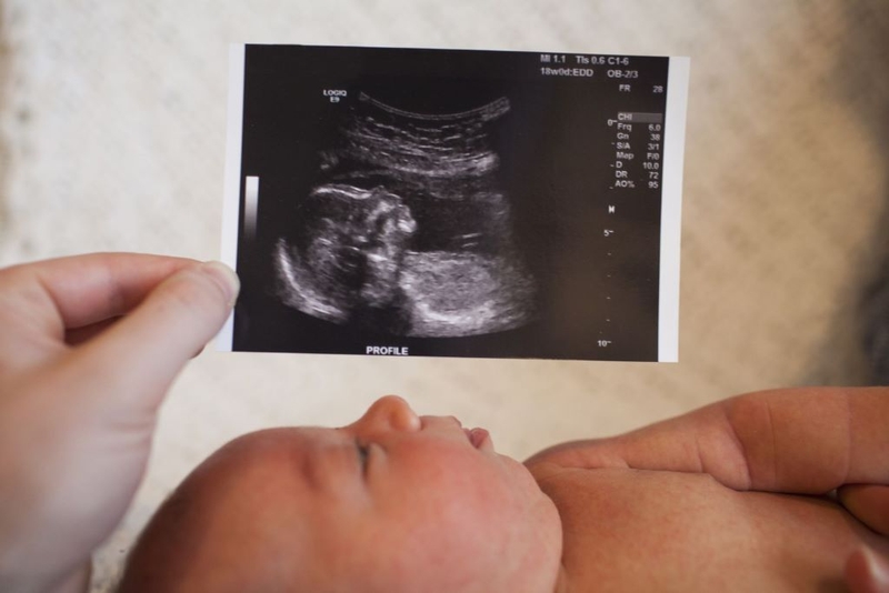 Mang thai 2 tuần siêu âm có thấy không? Thời điểm nào mẹ bầu nên siêu âm? 4