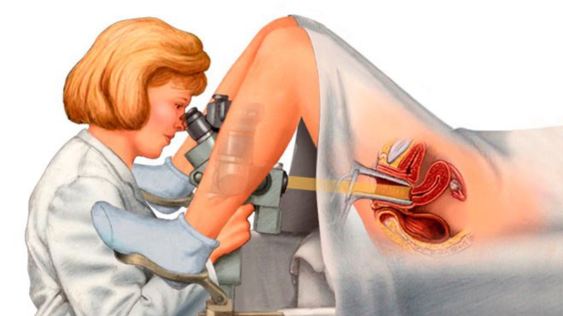 Mang thai có soi cổ tử cung được hay không? 1