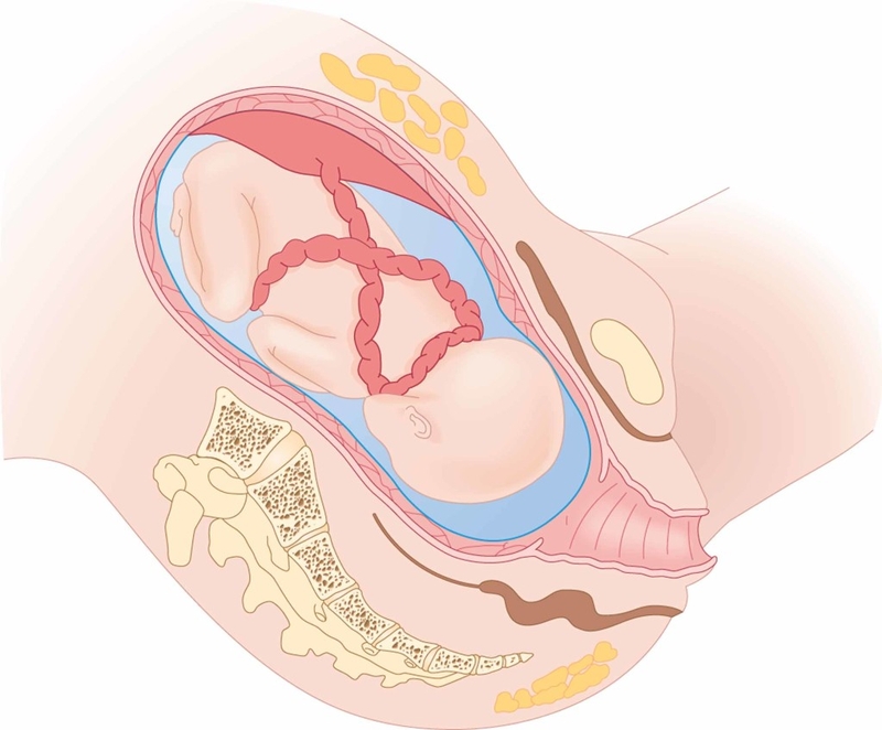 Nguyên nhân thú vị chuyện mẹ mang thai em bé bị nấc cụt 2