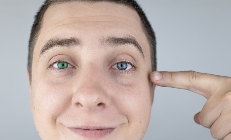 Mắt 2 màu có nguy hiểm không? Nguyên nhân và cách điều trị 1