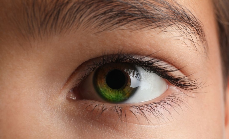 Mắt 2 màu có nguy hiểm không? Nguyên nhân và cách điều trị 3