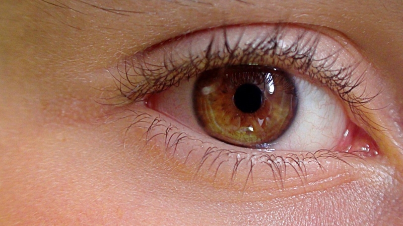 Mắt bị mờ sau chấn thương: Nguyên nhân, triệu chứng và cách điều trị hiệu quả 1