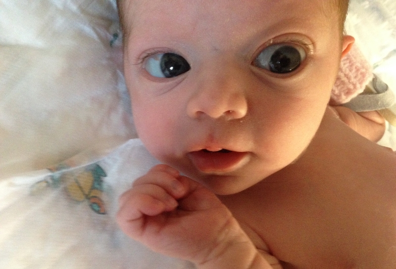 Mắt lồi bẩm sinh có nguy hiểm không? Nguyên nhân, triệu chứng, cách khắc phục 1