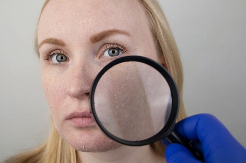 Mặt nạ đất sét hết hạn có dùng được không 3