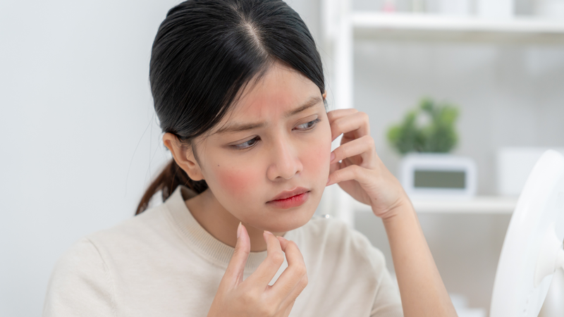 Tiềm ẩn rủi ro kích ứng, dị ứng, viêm da