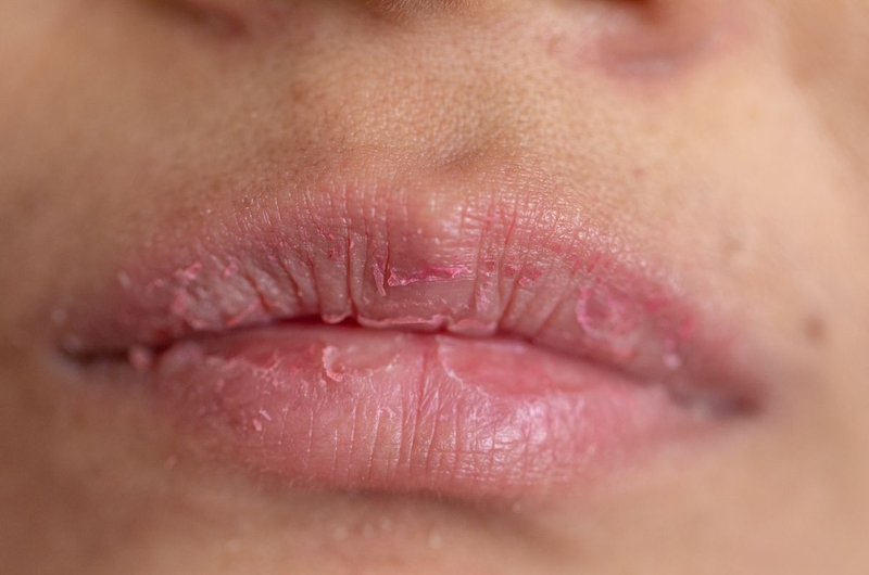 Có cần thiết bôi mặt nạ ngủ môi không? Mặt nạ ngủ cho môi có tác dụng gì 2