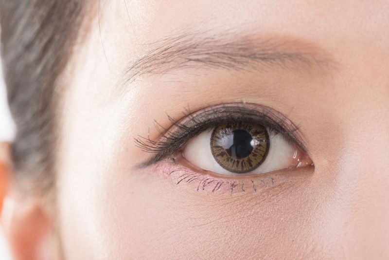 Mắt nhiều mí là như thế nào? Cách biến mắt nhiều mí thành 2 mí rõ đẹp 1