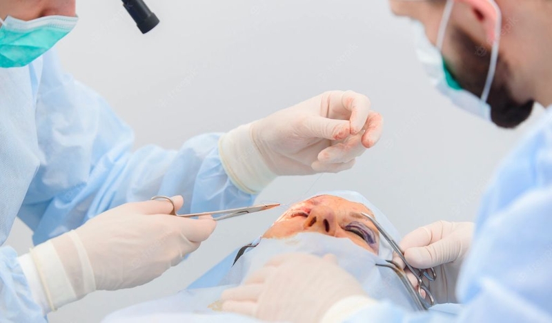 Mắt nhiều mí là như thế nào? Cách biến mắt nhiều mí thành 2 mí rõ đẹp 3