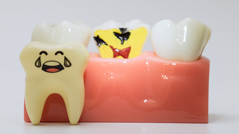 Mất răng gây nguy cơ làm lung lay và mất thêm răng thật bên cạnh