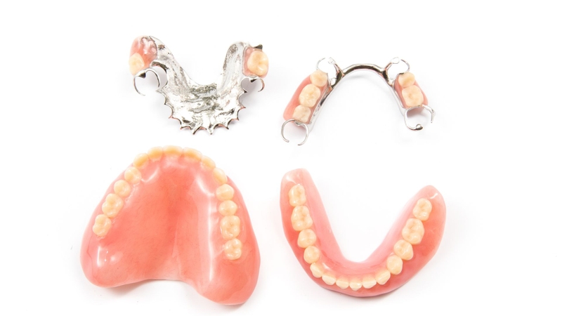 Mất răng số 2: Hậu quả và cách xử lý 4