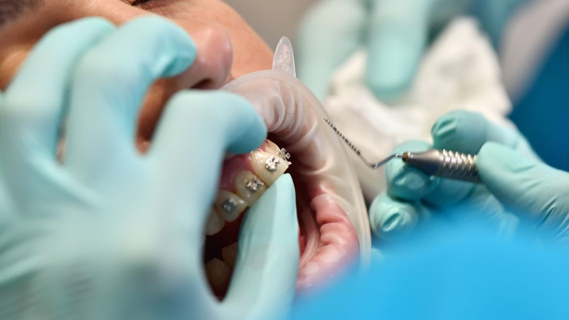 Bác sĩ sẽ đánh giá tình trạng răng thực tế để tư vấn có nên niềng răng hay không