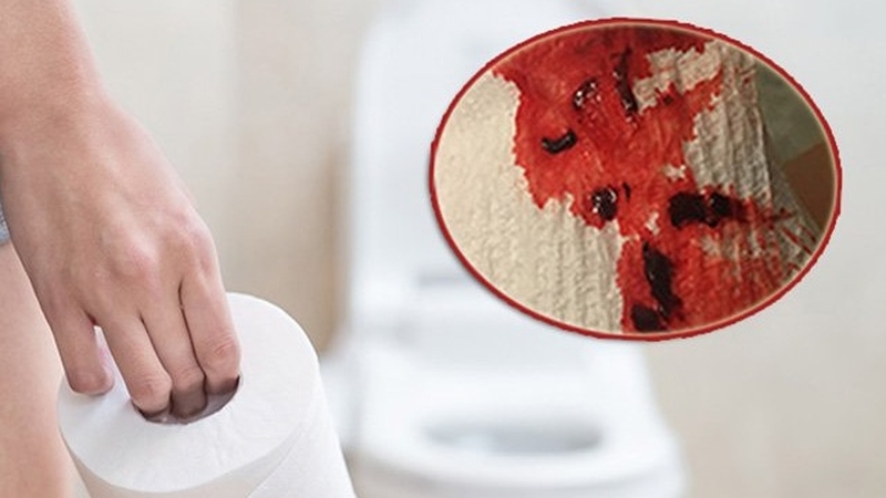 máu kinh ra cục thịt