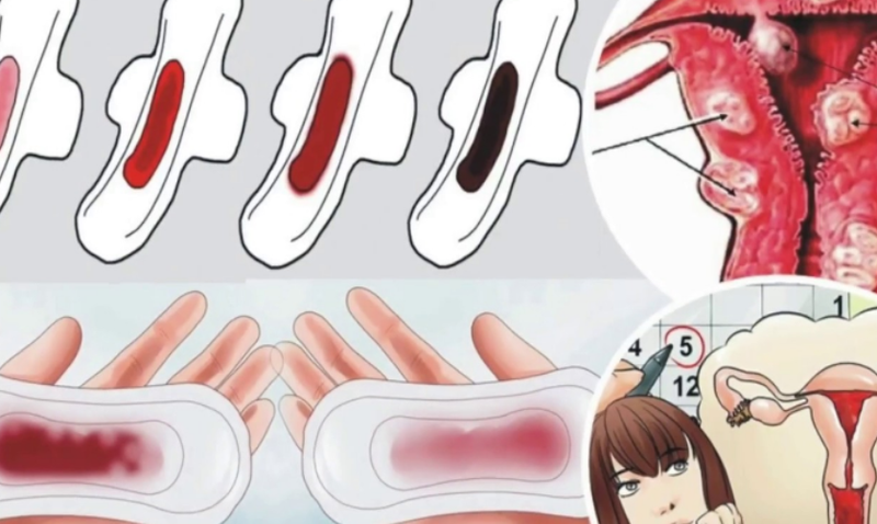 máu kinh ra cục thịt khi nào là bất thường