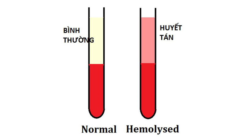 Mẫu máu bị vỡ hồng cầu ảnh hưởng như thế nào đến kết quả xét nghiệm? 1