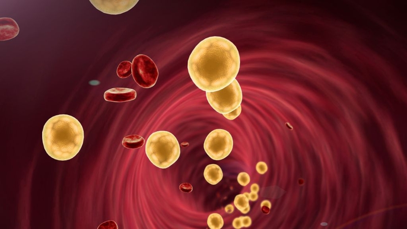 Máu nhiễm mỡ và men gan cao: Mối liên hệ nguy hiểm cần cảnh giác 1