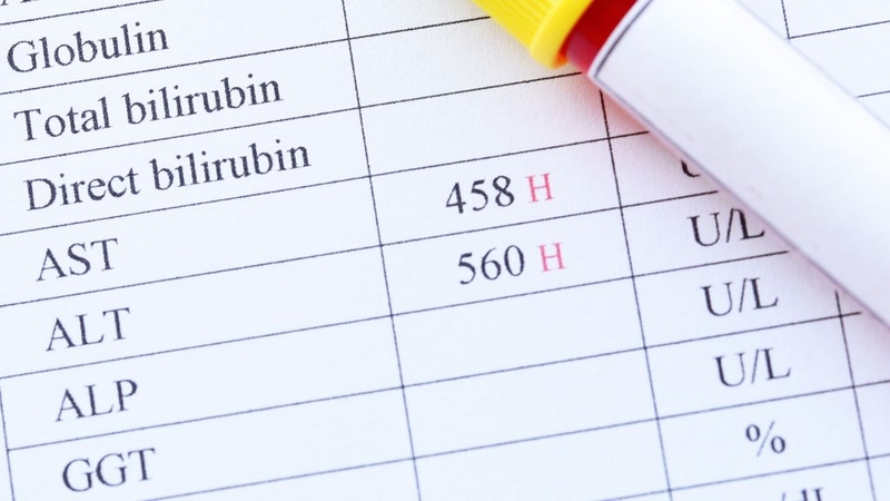 Máu nhiễm mỡ và men gan cao: Mối liên hệ nguy hiểm cần cảnh giác 2