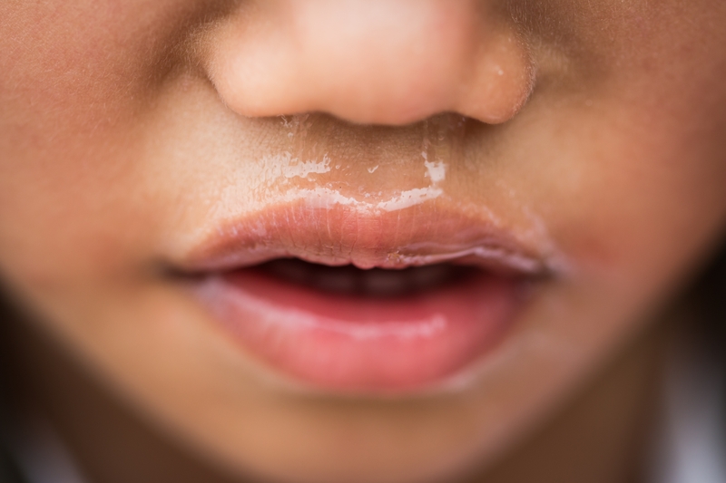 Màu sắc của nước mũi ảnh hưởng gì đến sức khoẻ