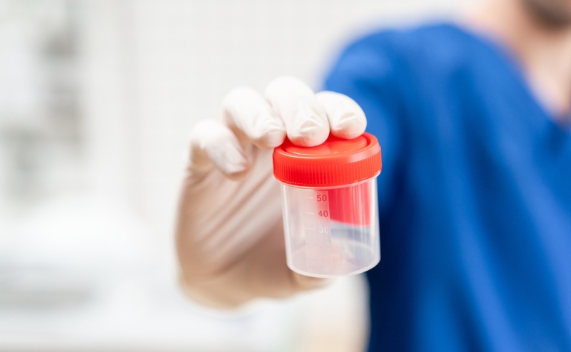 Màu sắc tinh dịch phản ánh những bệnh lý nào 1