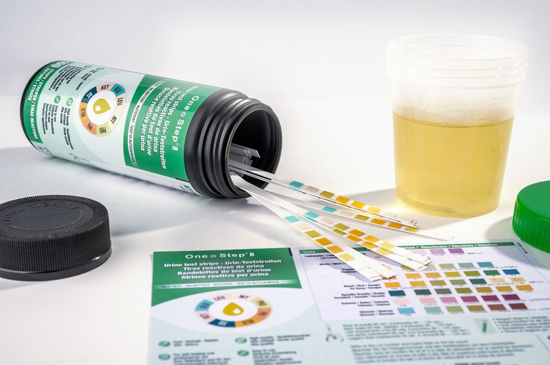 Máu trong nước tiểu: Nguyên nhân và cách điều trị 4