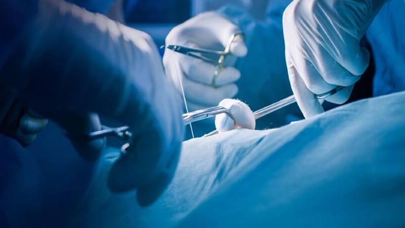 Máu tụ dưới màng cứng cấp tính: Nguyên nhân và điều trị 4