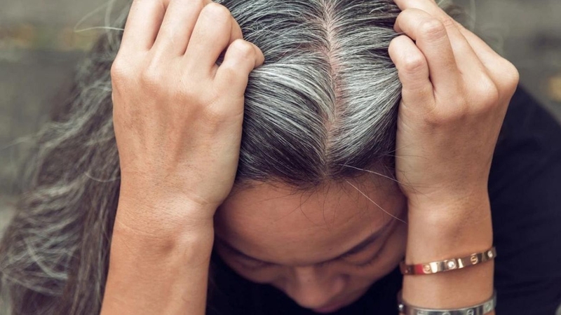 Máu xấu tóc bạc là quan niệm đúng hay sai? Nguyên nhân tóc bạc sớm 3