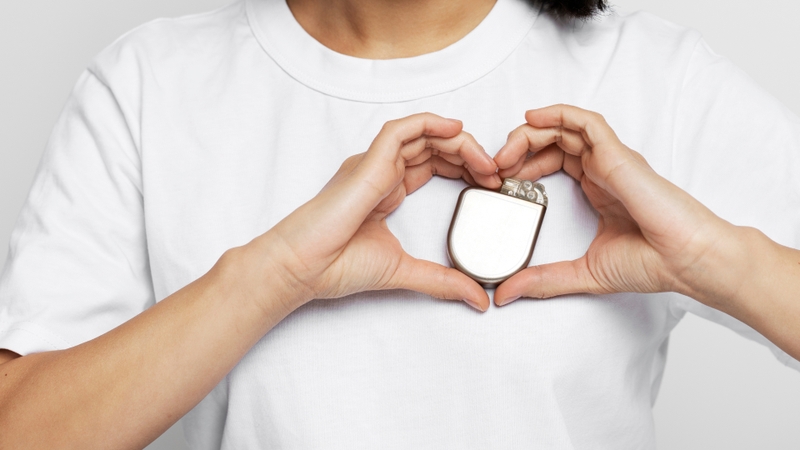 Máy khử rung tim cấy dưới da hoạt động như thế nào? 0