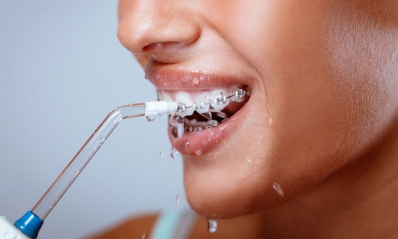 Máy tăm nước là gì? Có nên dùng tăm nước hay không? 3