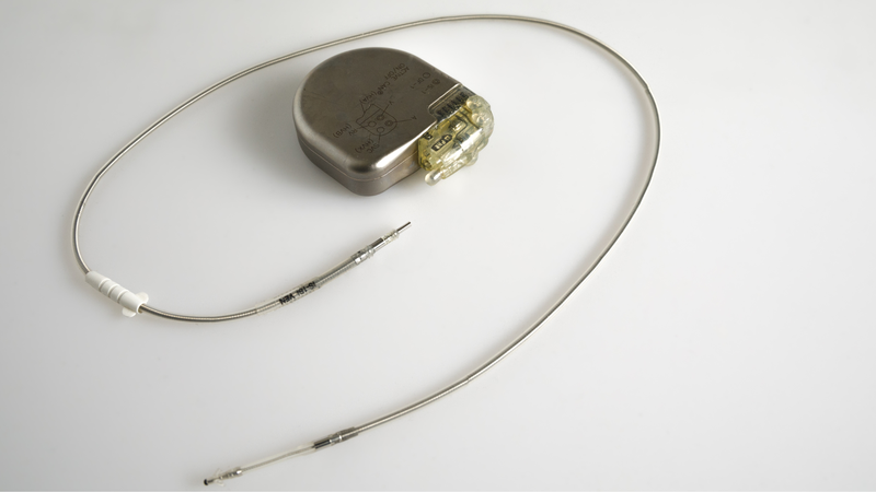 Máy tạo nhịp tim có an toàn không? 1